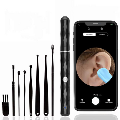 Ear Wax Removal Camera 1296P HD